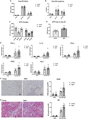 Altered gut microbiome plays an important role in AKI to CKD transition in aged mice